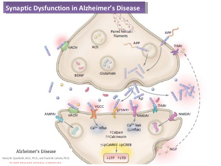 Image result for Alzheimer's disease synapse