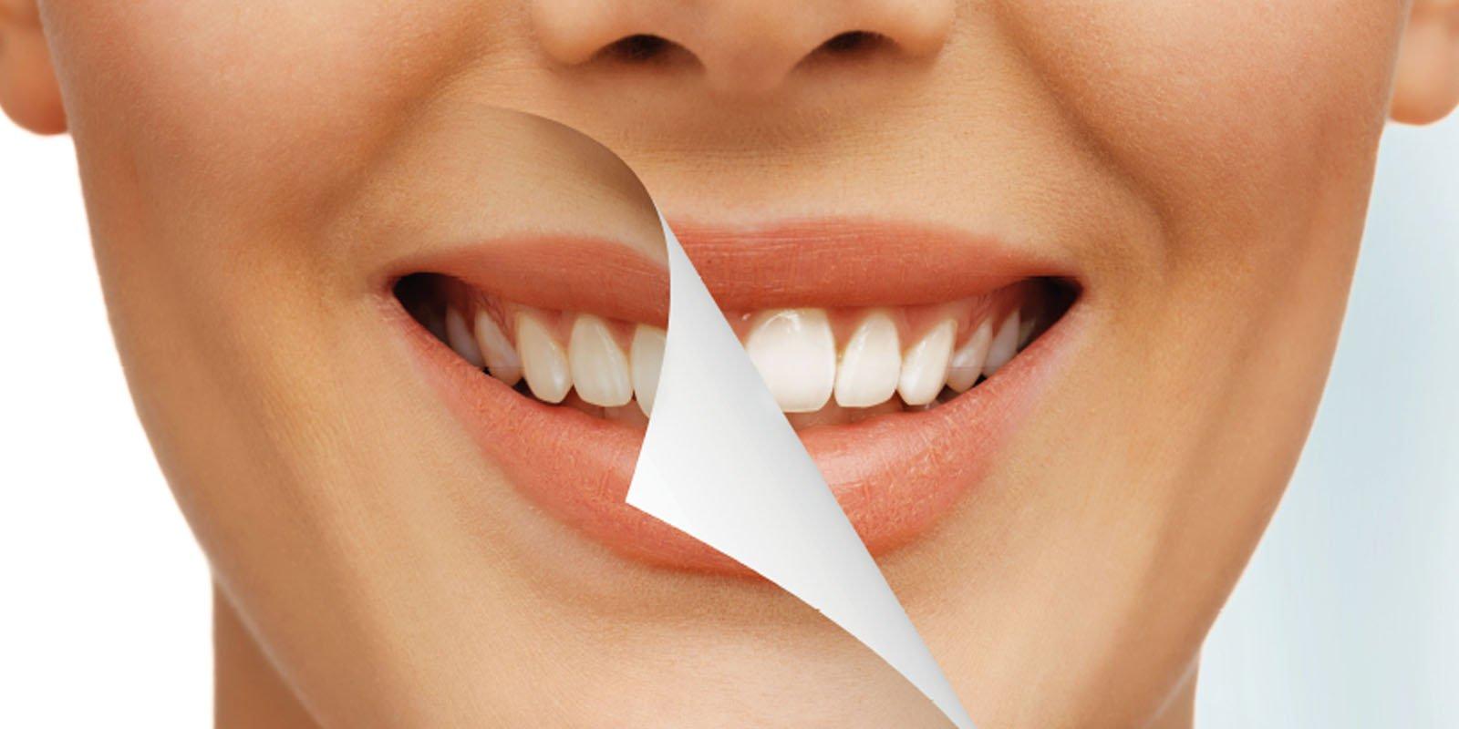 سریع ترین روش سفید شدن دندان در خانه