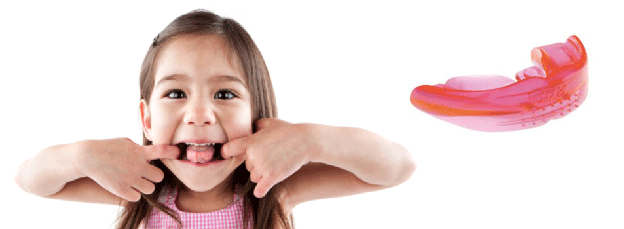 Aparat dentar mobil gutiera - Clinica SyroDent
