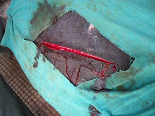 Skin incision in a buffalo (oblique ventrolateral approach) during c-section.