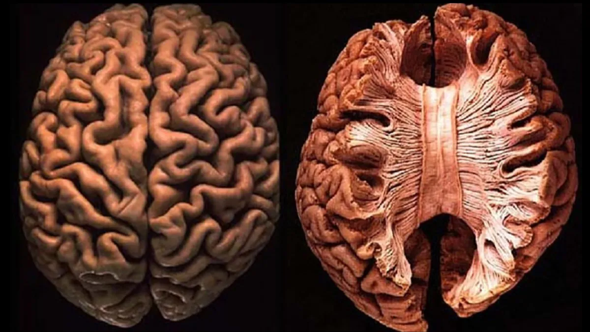 Beyin yapısı ve corpus callosum