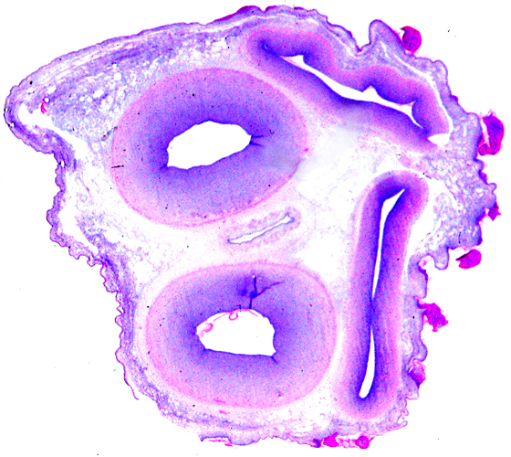 Umbilical cord with two arteries (left) and veins (right)