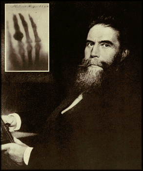Photo of Roentgen with the first X-ray photograph
