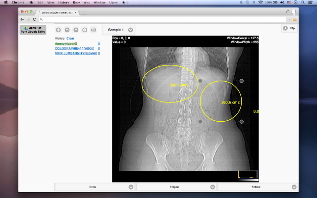 Screenshot of DICOM Medical Image Reader