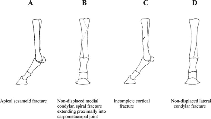 Examples of fracture injuries with similar clinical presentation