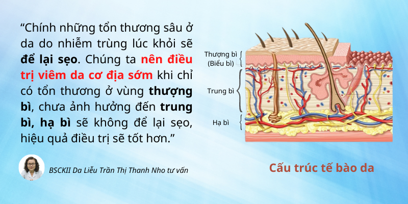 Nên điều trị viêm da cơ địa sớm khi các tổn thương chưa sâu để tránh sẹo