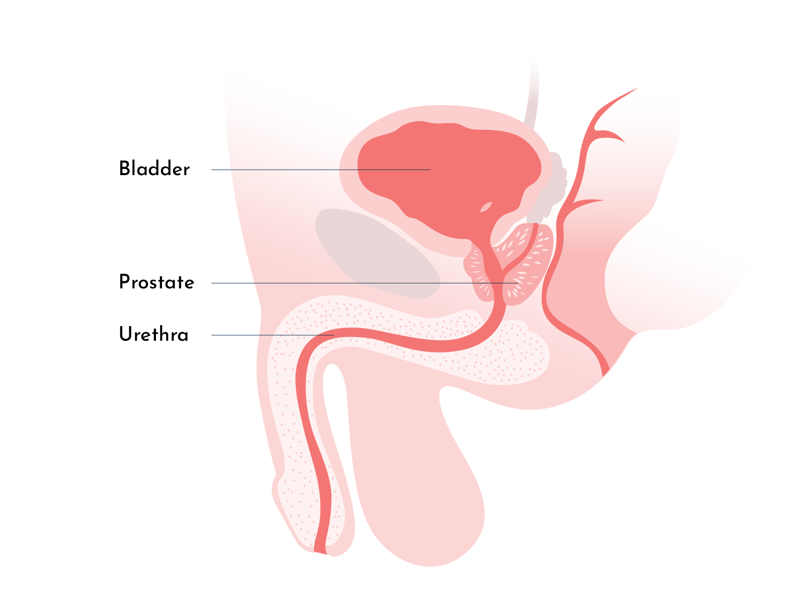 Male UTI treatment of prostate