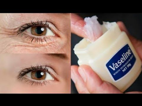 Natural Ways to Reduce Under-Eye Bags