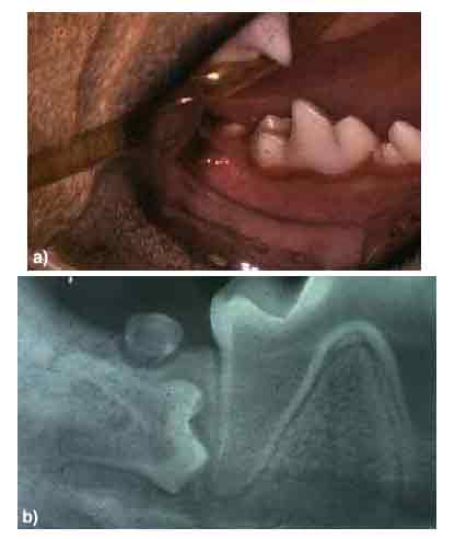 a) The photograph of a six-month-old Jack Russell Terrier indicates that the right mandibular second molar is absent. b) The radiograph of the area tells a different story. If this impacted/misoriented tooth were left in place and a dentigerous cyst formed around it, the periodontal support of the important first molar would likely be compromised. Therefore, the impacted second molar and the overlying third molar were removed.