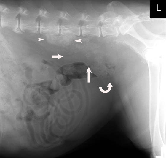 Lateral radiograph of the caudal abdomen of a 10 year old neutered male Labrador Retriever dog with lumbar pain, pelvic limb ataxia and paresis resulting from prostatic adenocarcinoma