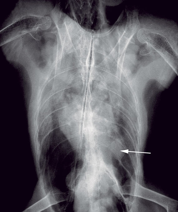 Radiograph of an Aspergillus granuloma (arrow) in the air sac of a blue and gold macaw