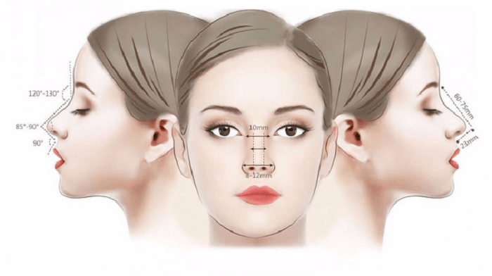 Bạn nên chọn kỹ thuật nâng mũi phù hợp với cơ địa của mình