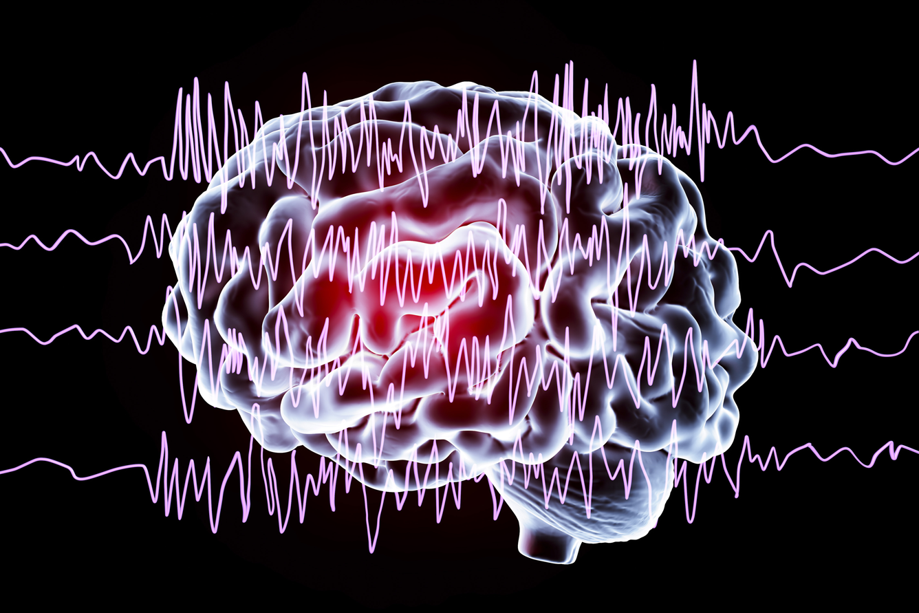 Причины развития и провоцирующие эпилепсию факторы