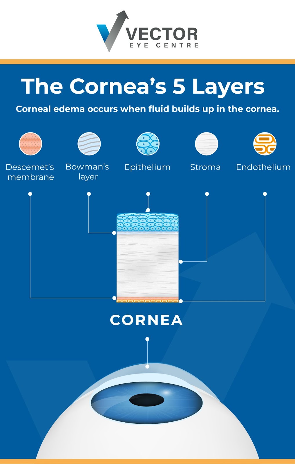 A pictorial representation of the 5 layers of the cornea.