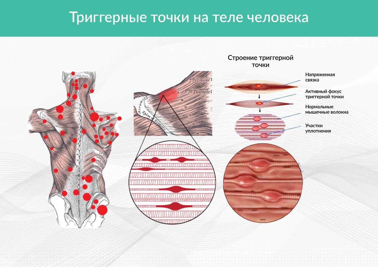 Болевой синдром у спортсменов - Лечение в Москве ~【Клиника Традиция】