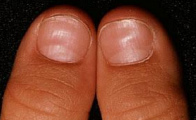 Skin infection pictures and treatments
