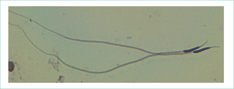 Espermatozoide de Crotalus spp. Se aprecia la cabeza que presenta el núcleo teñido de azul y el acrosoma translúcido, el flagelo con una pieza media extremadamente larga y una cola final aparentemente desnuda 40X.