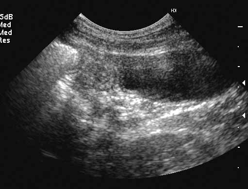 Vista transversal del útero en metaestro (diestro)