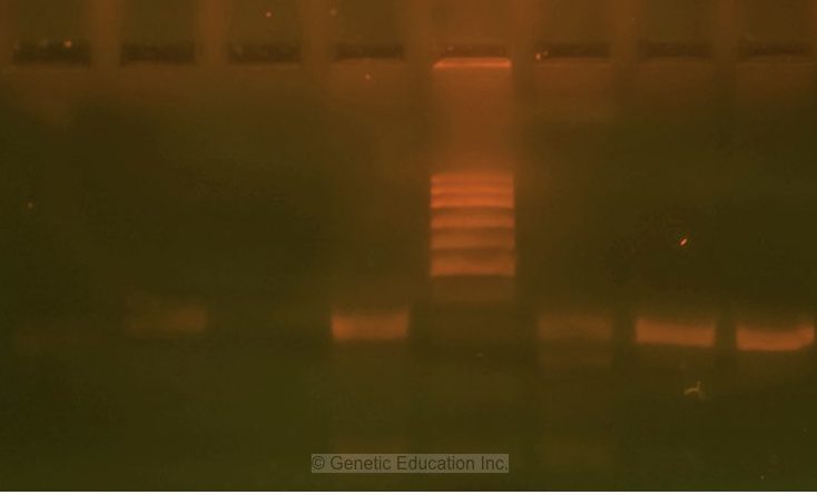 PCR gel electrophoresis result image  1.