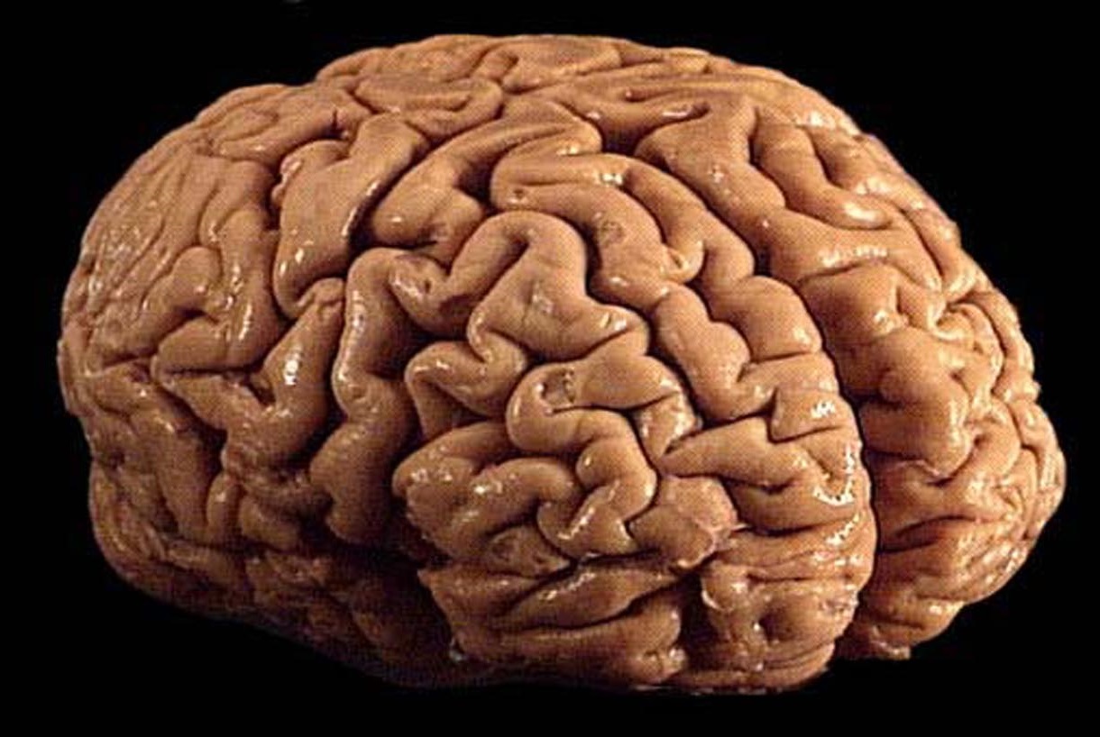 File:Brain 01.jpg - Wikimedia Commons