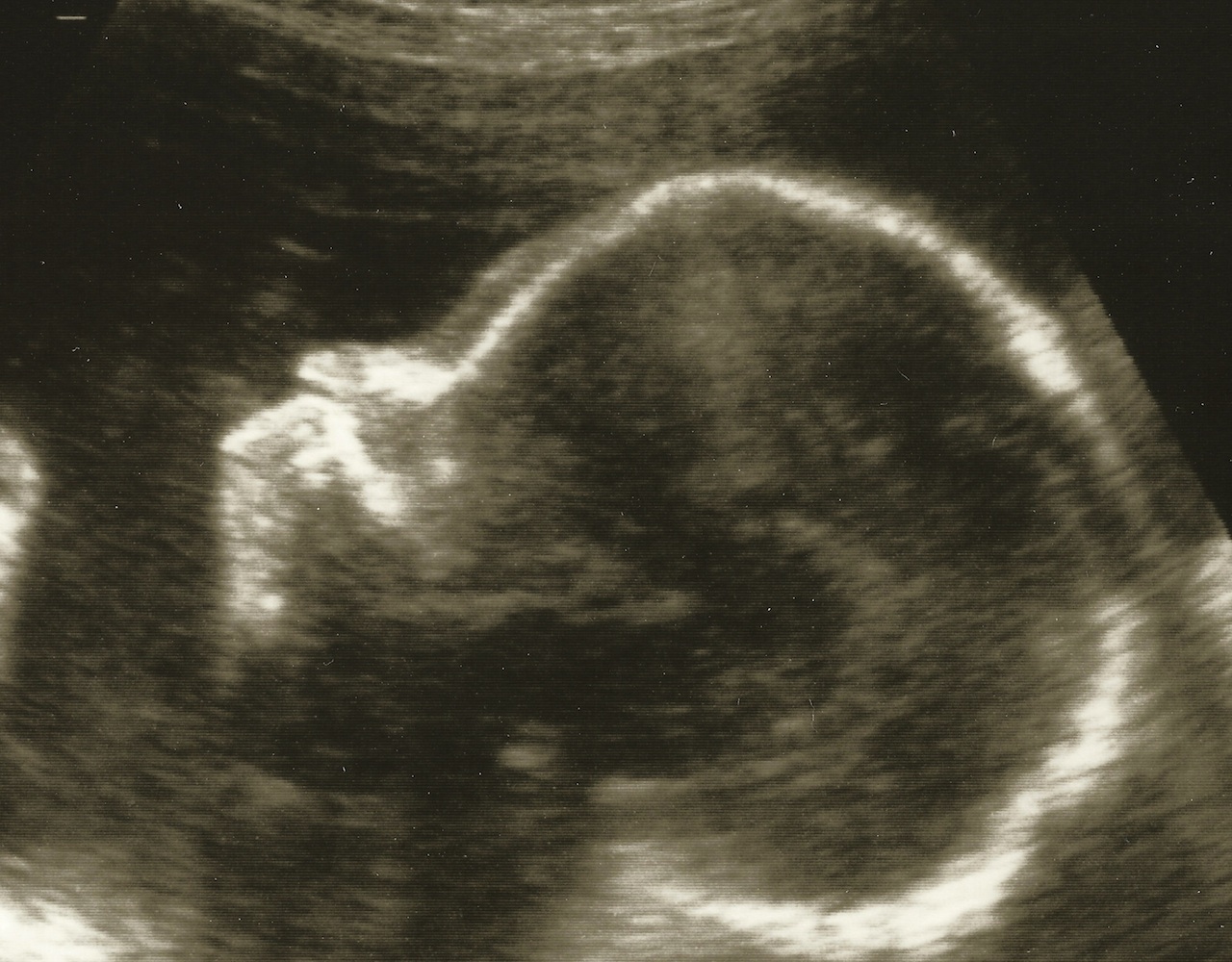 28 Week ultrasound 2_cropped_resized.jpg