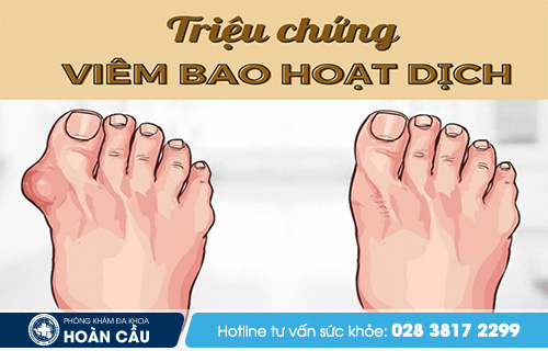 Viêm bao hoạt dịch - Đa khoa Hoàn Cầu  Dz_DwYwKa1GiJ-cI3sX1w6wlRIdlvF49rz8TfUK_D_uv9KxF6gsweAQjxQS3hPXRSNvVBZ6KNeeu8nwgtW_MAUcyttVENxIzDf1L1JDwEdgQXI2voPeZ3LBNqDNfQc6uXJG_rfRFGp67cZ76JaJ7o8o