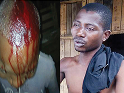 Man breaks 13-year-old apprentice’s head with padlock