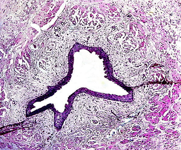 Allantoic duct accompanied by small amount of bladder musculature and small blood vessels.