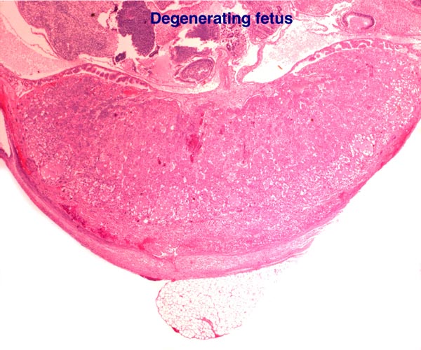 Maternal blood vessel in the decidua