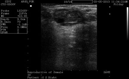 Transrectal sonogram of an anestrus buffalo showing a completely echogenic CL.