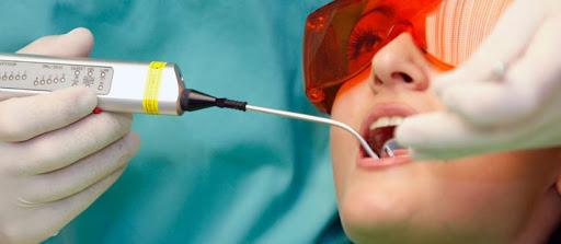 Лечение зубов лазером: преимущества и недостатки - фото 2