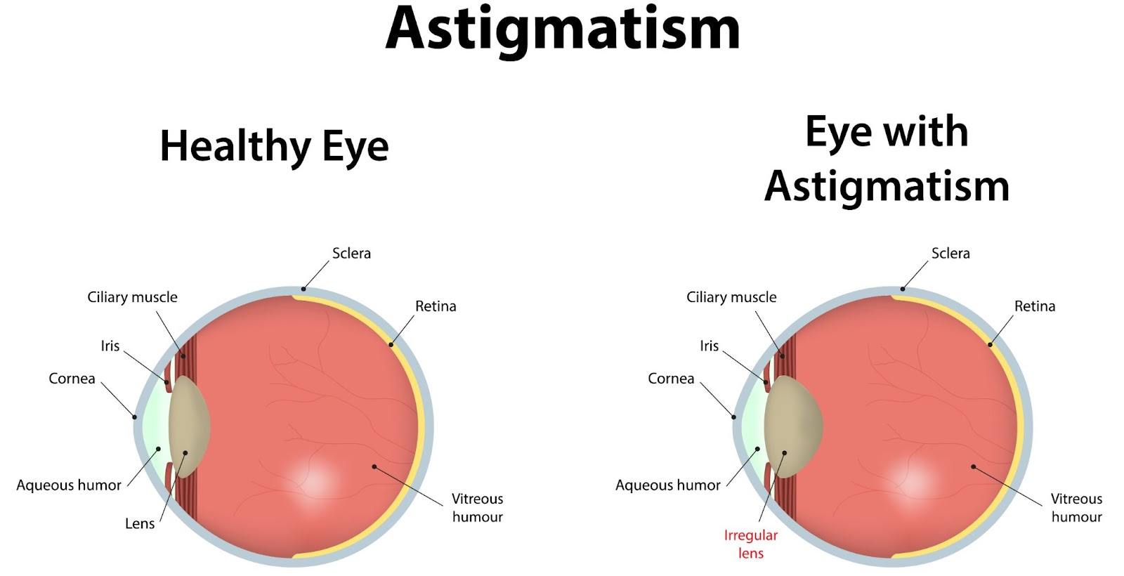 Test for astigmatisme – online test du kan udføre selv