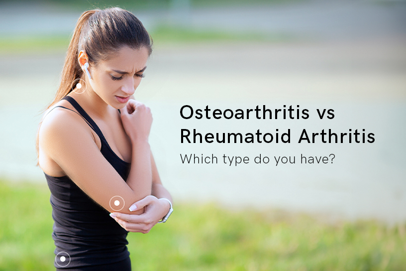 The Guide to Arthritis: Types, Symptoms, Solutions