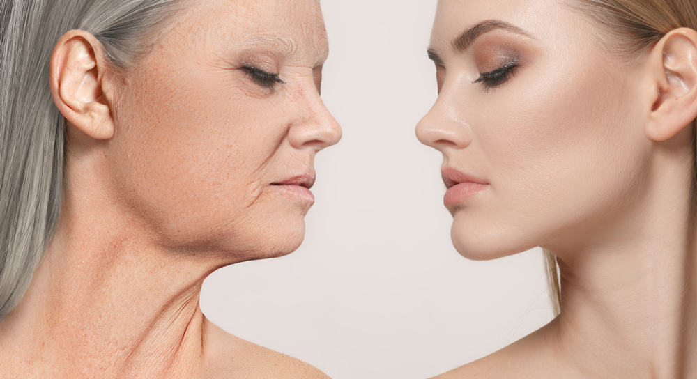 Ưu điểm căng da mặt bằng chỉ Collagen tại Thẩm Mỹ Việt Nam - Khắc phục được các dấu hiệu lão hóa trên gương mặt