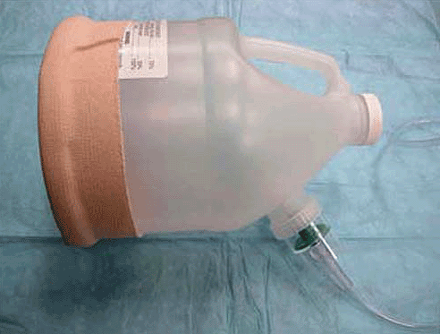 Mask. An effective mask can be simply made by modification of a plastic 1-gal container. The nebulization chamber is inserted in a location that makes handling the apparatus convenient.