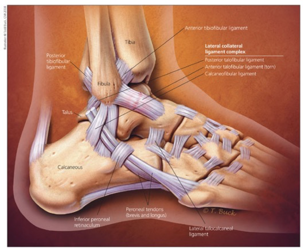ankle lateral collateral ligament injury