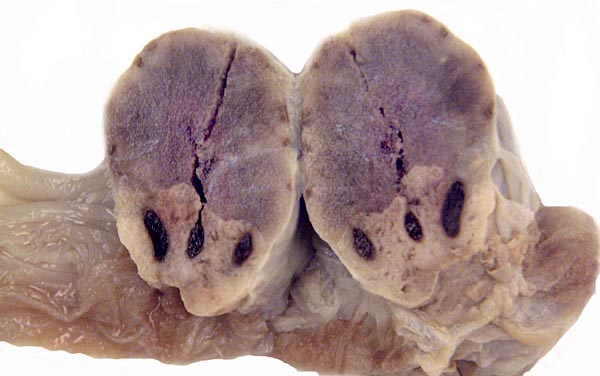 Cross section of fully fixed term, delivered beaver placenta