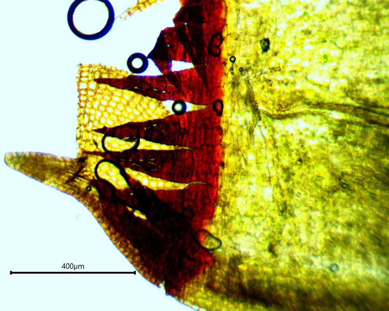 Schistidium apocarpum 100x capsule w scale 2.jpg