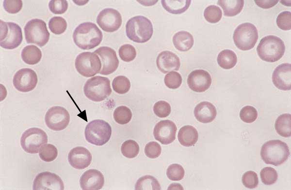 Canine blood. Regenerative anemia with spherocytes...