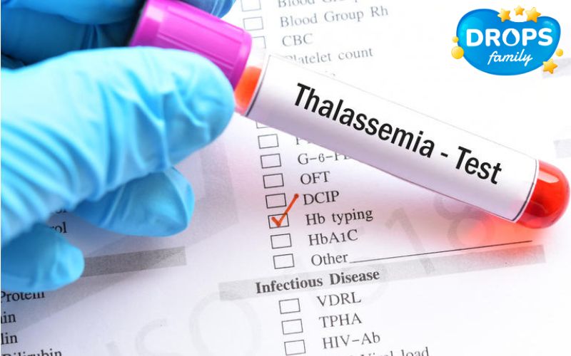 Kích thước hồng cầu to nhỏ không đều trong bệnh Thalassemia
