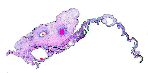 Cross section of the vitelline portion of the umbilical cord with attached vascularized vitelline membrane.