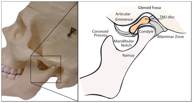 Resumo de disfunção temporomandibular: diagnóstico, tratamento e mais!