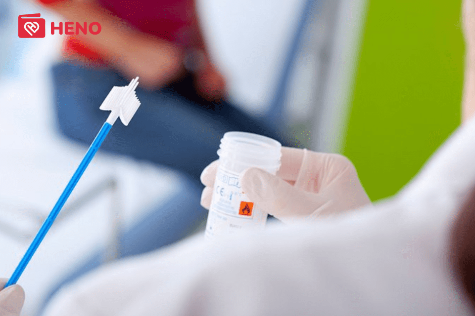 bộ xét nghiệm HPV test