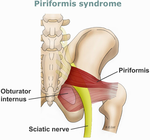 Numbness and Tingling in Your Legs - Have You Been Checked For Piriformis  Syndrome? - Respire Physical Therapy