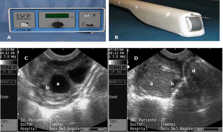 A. Vacuum pump, B. A 5.0 MHz convex transducer provided with an 18 g needle. C. Image of buffalo ovarian follicles (a) Follicles > 8 mm diameter, (b) a 3 mm diameter follicle. D. Image of ovarian structures, (a) corpus luteum, (b) a 3 mm diameter follicle, and (d) a cross-sectional view of the uterine horn.