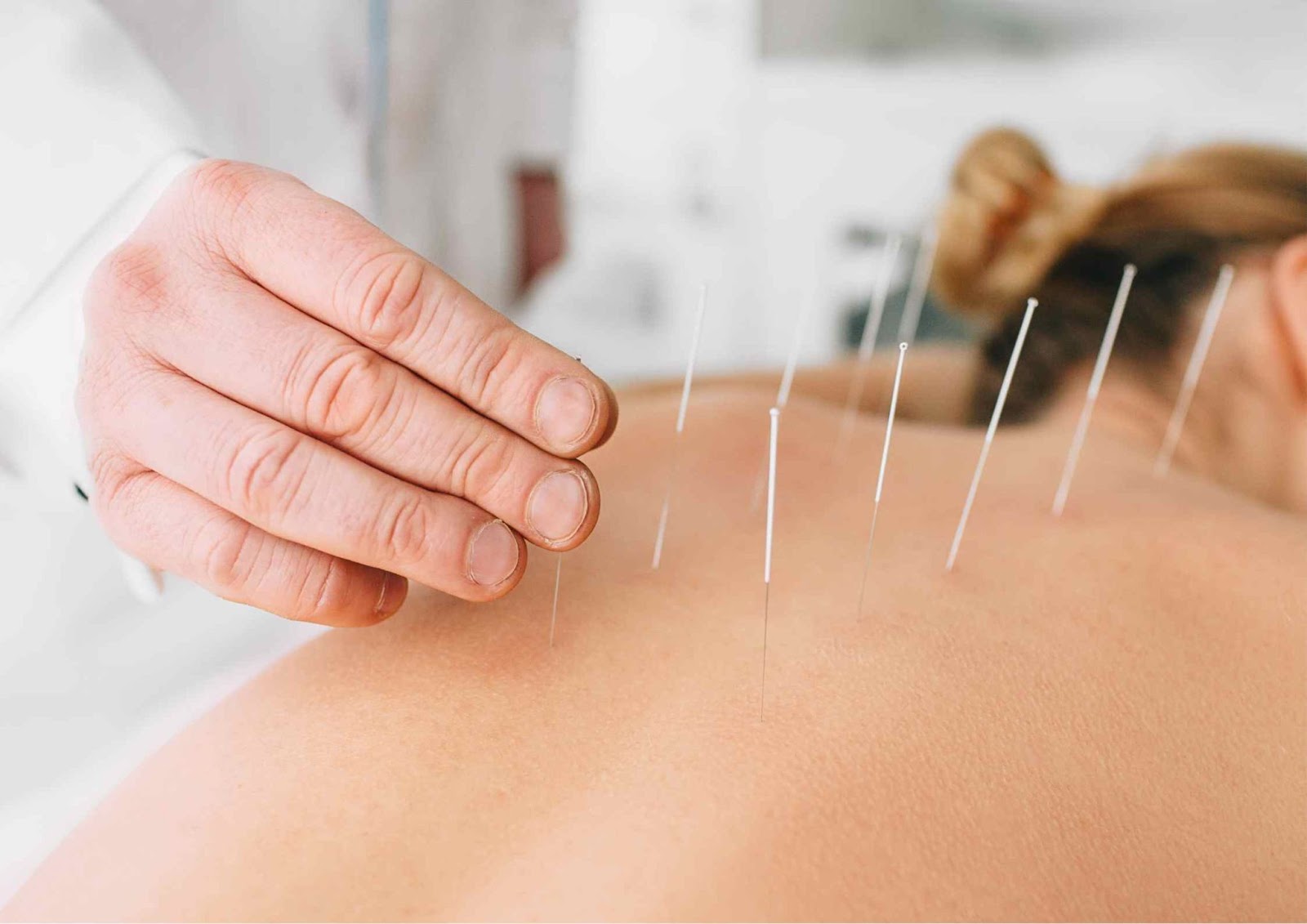 TCM Acupuncture for Eczema in Malaysia