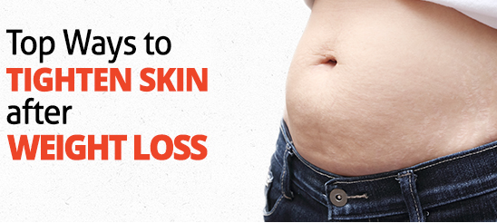 How to avoid loose skin after weight loss?