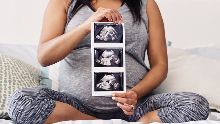 هل يتأثر شكل الجنين بما تراه الأم الحامل؟ | مسبار