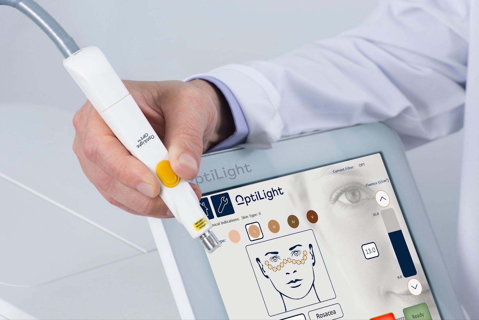 An optometrist using the OptiLight IPL therapy interface to treat a patient's dry eyes.