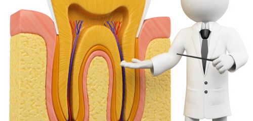 Viêm tủy răng là gì, triệu chứng viêm tủy?